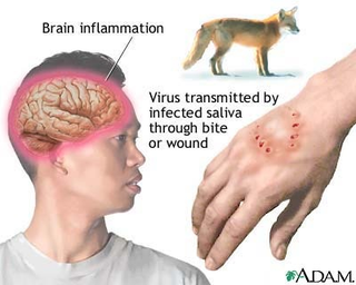 Illustration for article titled 5 real diseases that could make you act just like a zombie